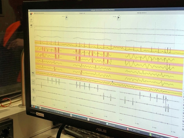 The relative track geometry is measured using an inertial measuring system.